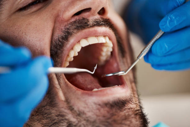 Best Wisdom Tooth Removal  in Newell, WV